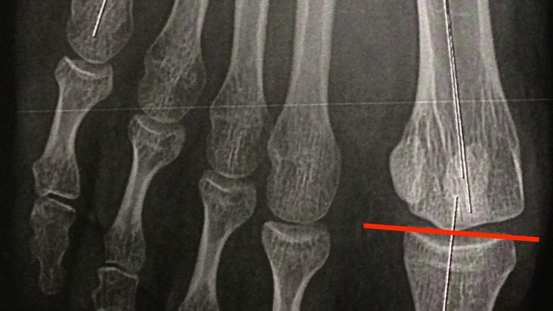轴承生锈了怎么办？去除锈迹的实用步骤